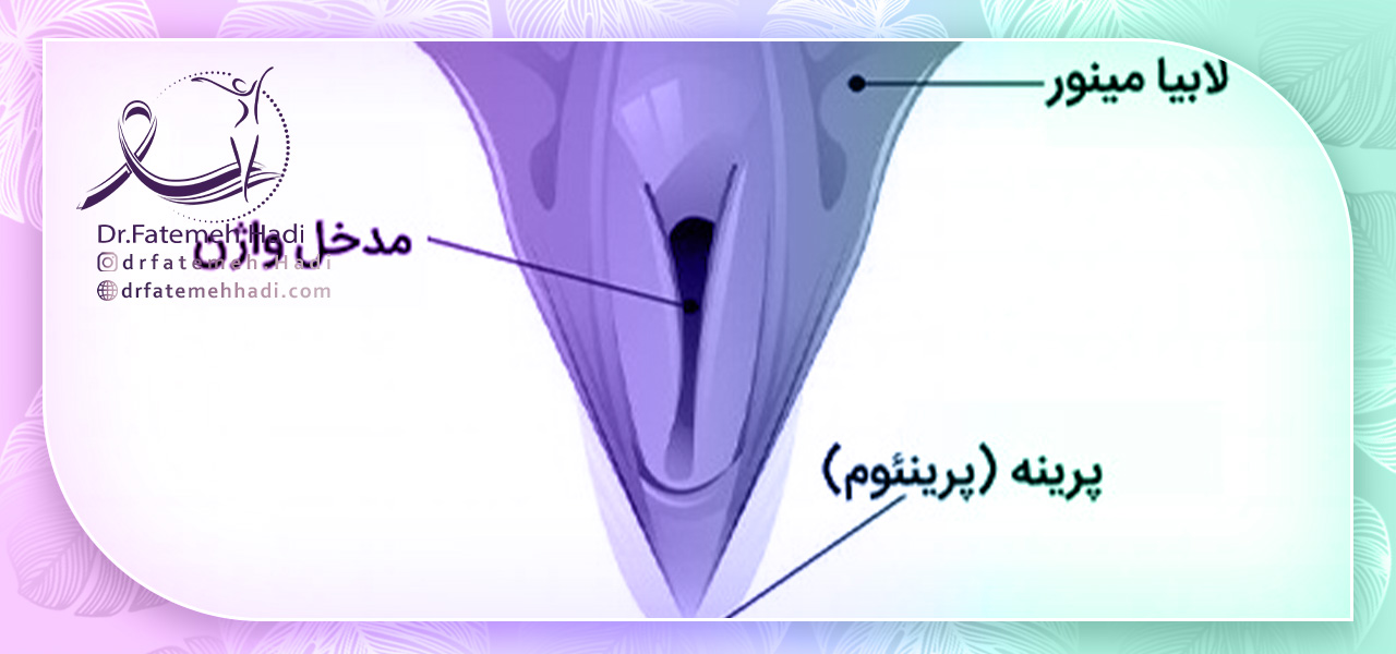 انواع روش های تنگ کردن واژن