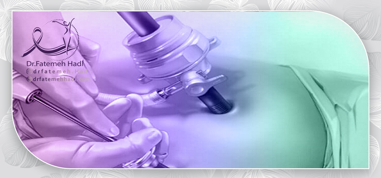 موارد منع لاپاراسکوپی