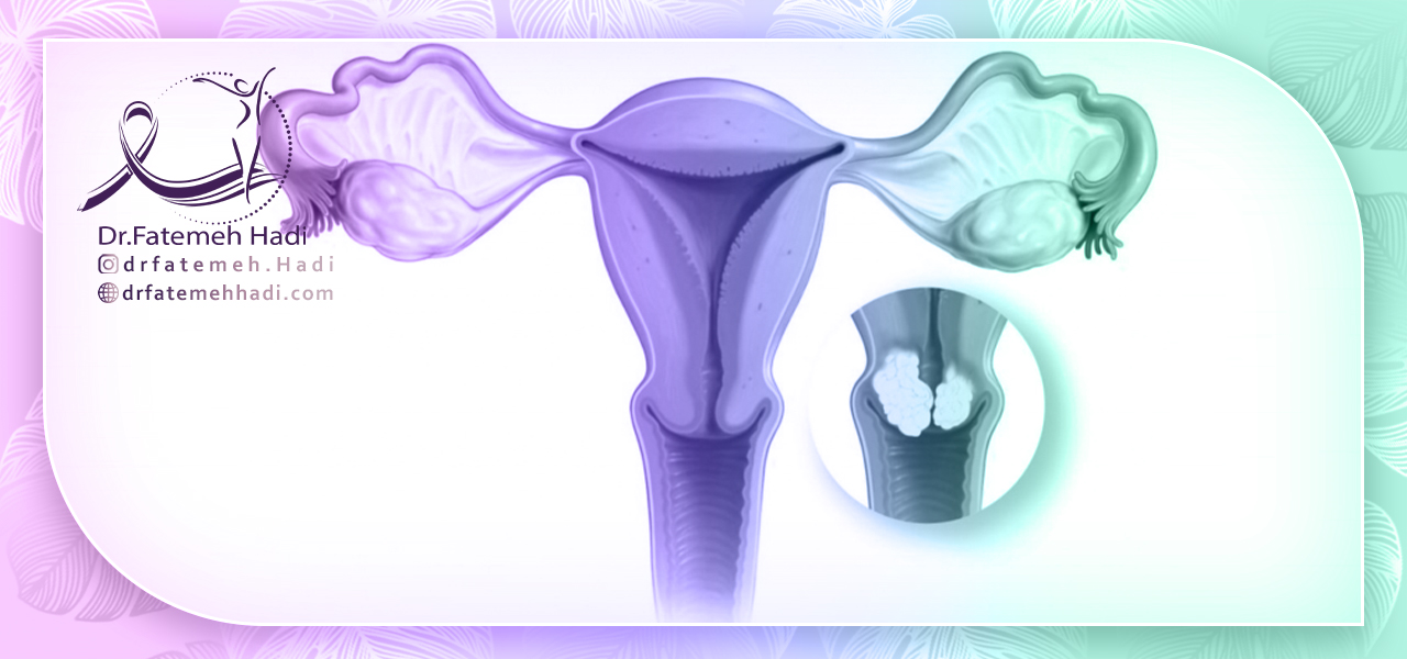 علائم سرطان دهانه رحم