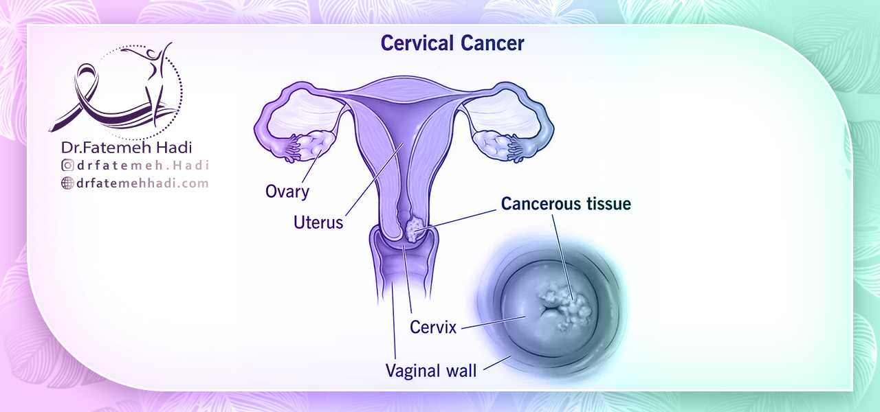 عوارض <yoastmark class=
