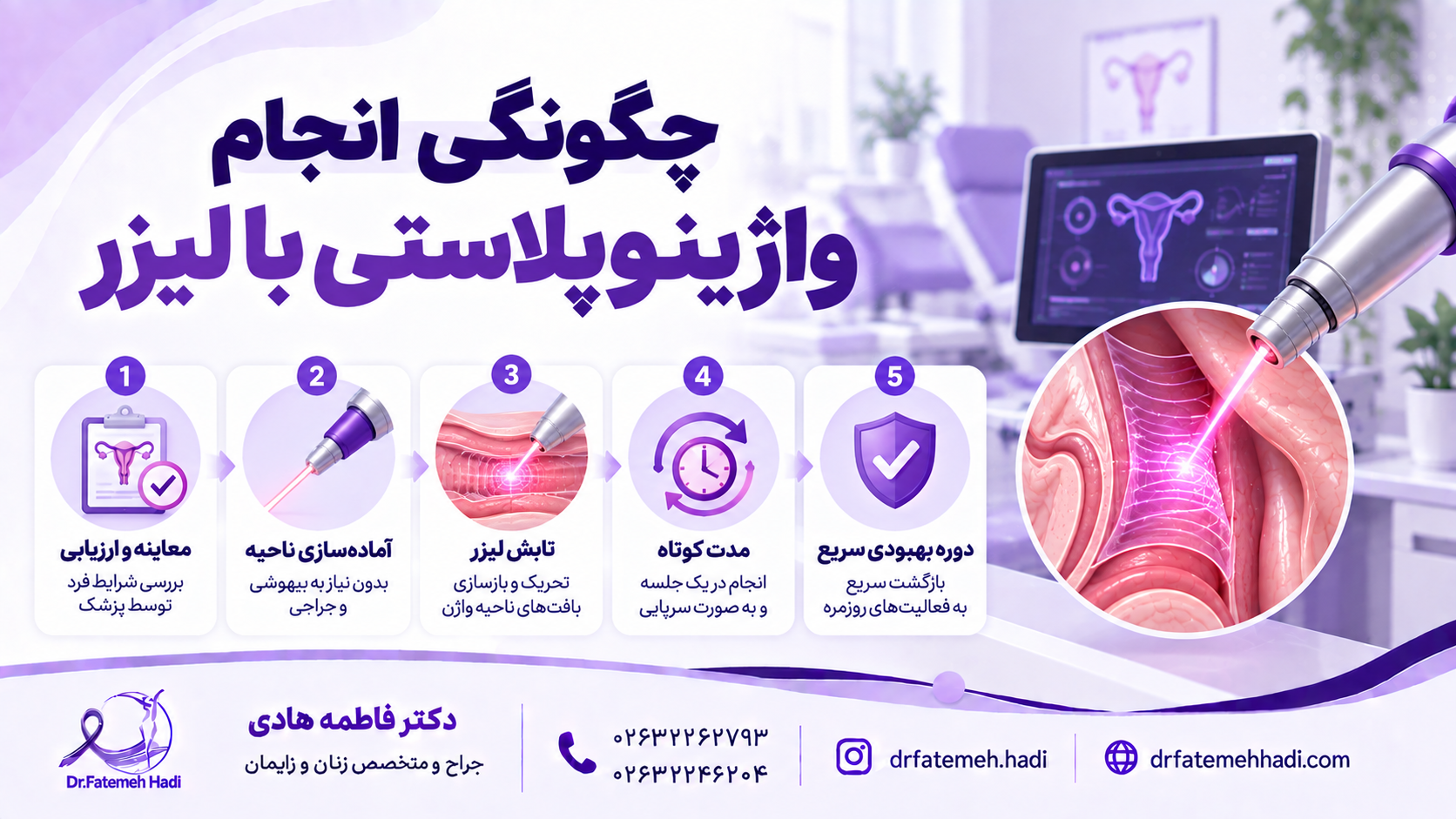 چگونگی انجام واژینوپلاستی با لیزر